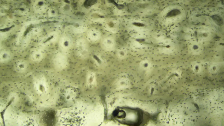 The figure shows a histological section of animal bone at x100 magnification, 14 days after death.